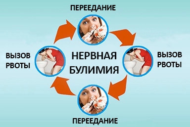 Лечение булимии в Великом Новгороде